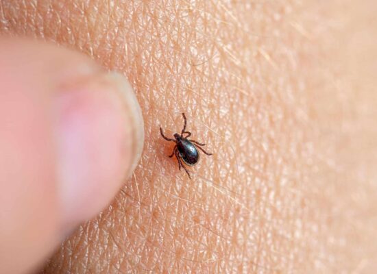 Close-up of a tick on human skin, pest control needed
